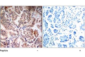 Image no. 1 for anti-Protein Kinase, AMP-Activated, alpha 1 Catalytic Subunit (PRKAA1) (Thr174) antibody (ABIN197410)