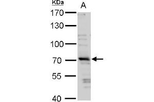 WB Image TRIM32 antibody detects TRIM32 protein by western blot analysis.