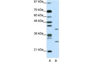 WB Suggested Anti-ZFP36L1 Antibody Titration: 1. (ZFP36L1 anticorps  (N-Term))
