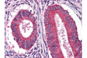 Immunohistochemical analysis of paraffin-embedded human Uterus tissues using anFtEG mouse mAb (EGF anticorps)