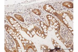 Immunoperoxidase of purified MaxPab antibody to CC2D1A on formalin-fixed paraffin-embedded human small Intestine.