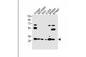 All lanes : Anti-VDAC3 Antibody (Center) at 1:1000 dilution Lane 1: Human heart lysate Lane 2: NCI- whole cell lysate Lane 3: A431 whole cell lysate Lane 4: U-2OS whole cell lysate Lane 5: Mouse testis lysate Lane 6: Mouse heart lysate Lysates/proteins at 20 μg per lane.