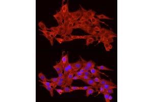 Immunofluorescence analysis of PC-12 cells using POMC Rabbit pAb (ABIN3017230, ABIN3017231, ABIN3017232 and ABIN6220004) at dilution of 1:200 (40x lens).