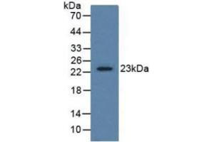 Rabbit Detection antibody from the kit in WB with Positive Control:  Sample Human prostate tissue. (GREM1 Kit ELISA)