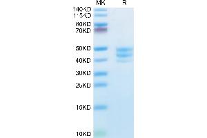 Human PSCA on Tris-Bis PAGE under reduced condition. (PSCA Protein (AA 12-86) (Fc Tag))