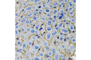 Immunohistochemistry of paraffin-embedded rat liver using RAF1 antibody. (RAF1 anticorps)
