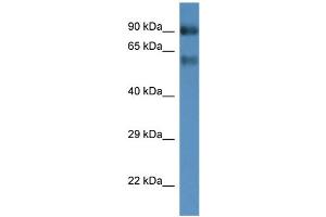 WB Suggested Anti-Slc6a15 Antibody   Titration: 1.