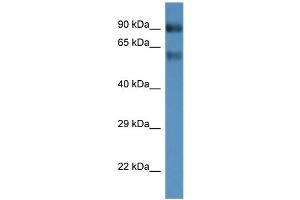 WB Suggested Anti-Slc6a15 Antibody   Titration: 1. (SLC6A15 anticorps  (Middle Region))