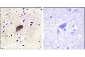 Immunohistochemistry analysis of paraffin-embedded human brain, using PAK1/2/3 (Phospho-Ser144/141/139) Antibody.