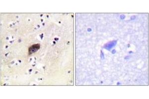 Immunohistochemistry analysis of paraffin-embedded human brain, using PAK1/2/3 (Phospho-Ser144/141/139) Antibody. (PAK1/2/3 anticorps  (pSer144))
