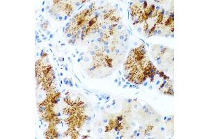 Immunohistochemistry of paraffin-embedded human stomach using LAMB3 antibody (ABIN5974494) at dilution of 1/100 (40x lens). (Laminin beta 3 anticorps)