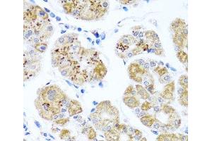 Immunohistochemistry of paraffin-embedded Human stomach using PIP4K2B Polyclonal Antibody at dilution of 1:100 (40x lens).