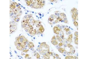 Immunohistochemistry of paraffin-embedded Human stomach using PIP4K2B Polyclonal Antibody at dilution of 1:100 (40x lens). (PIP4K2B anticorps)