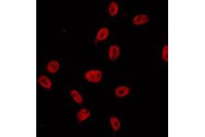 ABIN6274686 staining A549 by IF/ICC. (Exonuclease 1 anticorps  (N-Term))