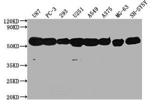 Western Blot Positive WB detected in: U87 whole cell lysate, PC-3 whole cell lysate, 293 whole cell lysate, U251 whole cell lysate, A549 whole cell lysate, A375 whole cell lysate, MG-63 whole cell lysate, SH-SY5Y whole cell lysate, All lanes: TUBA1A antibody at 1:5000 Secondary Goat polyclonal to Mouse IgG at 1/10000 dilution Predicted band size: 52 kDa Observed band size: 52 kDa