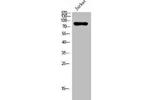 Western Blot analysis of Jurkat cells using Nox5 Polyclonal Antibody (NOX5 anticorps  (C-Term))