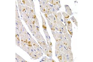 Immunohistochemistry of paraffin-embedded mouse heart using DSP antibody. (Desmoplakin anticorps)