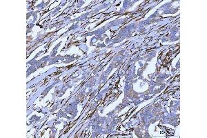 IHC analysis of Hsp47/SERPINH1 using anti-Hsp47/SERPINH1 antibody (ABIN3043331). (SERPINH1 anticorps  (AA 247-418))