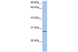 PEMT antibody used at 1 ug/ml to detect target protein.