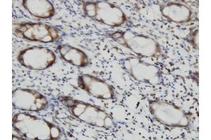 Immunoperoxidase of monoclonal antibody to RALB on formalin-fixed paraffin-embedded human colon.