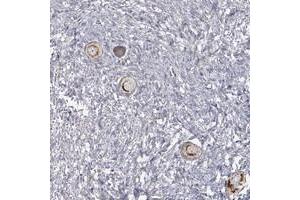 Immunohistochemical staining of human ovary with LACTB polyclonal antibody  shows strong granular cytoplasmic positivity in follicle cells at 1:200-1:500 dilution. (LACTB anticorps)