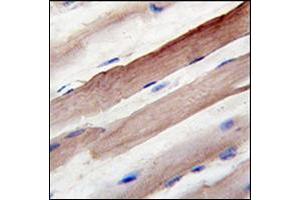 Formalin-fixed and paraffin-embedded human skeletal muscle reacted with Autophagy AAPG4B / ATG4B Antibody , which was peroxidase-conjugated to the secondary antibody, followed by DAB staining.
