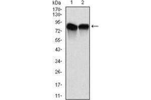 Western Blotting (WB) image for anti-Neural Precursor Cell Expressed, Developmentally Down-Regulated 8 (NEDD8) antibody (ABIN1108404) (NEDD8 anticorps)