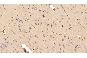 Detection of TF in Porcine Cerebrum Tissue using Polyclonal Antibody to Transferrin (TF)