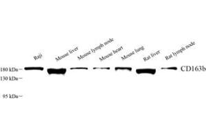 Western blot analysis of CD163b (ABIN7073371) at dilution of 1: 1000 (CD163L1 anticorps)