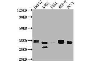 Western Blot Positive WB detected in: HepG2 whole cell lysate, K562 whole cell lysate, U251 whole cell lysate, MCF-7 whole cell lysate, PC-3 whole cell lysate All lanes: RPIA antibody at 1:2000 Secondary Goat polyclonal to rabbit IgG at 1/50000 dilution Predicted band size: 34 kDa Observed band size: 33 kDa (Ribose 5-Phosphate Isomerase A (RPIA) (AA 1-311) anticorps)