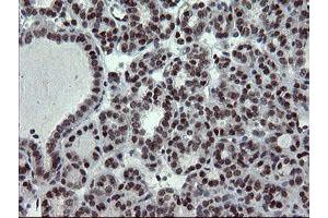 Image no. 4 for anti-Ubiquitin-Conjugating Enzyme E2E 3 (UBE2E3) antibody (ABIN1501618)