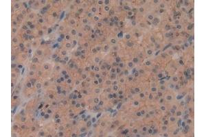 Detection of SIRT2 in Rat Stomach Tissue using Polyclonal Antibody to Sirtuin 2 (SIRT2)