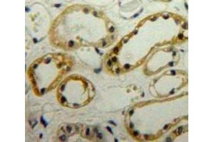 IHC-P analysis of Kidney tissue, with DAB staining. (LIMS1 anticorps  (AA 68-303))