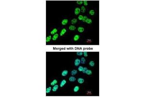 ICC/IF Image Immunofluorescence analysis of paraformaldehyde-fixed A431, using hnRNP F , antibody at 1:200 dilution.