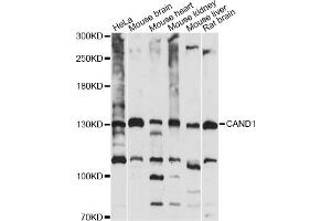 Western blot analysis of extracts of various cell lines, using CAND1 antibody (ABIN6291857) at 1:1000 dilution. (CAND1 anticorps)