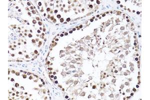 Immunohistochemistry of paraffin-embedded mouse testis using PCNA antibody. (PCNA anticorps  (AA 1-261))