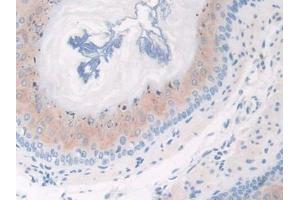 Used in DAB staining on fromalin fixed paraffin- embedded esophagus tissue (CFP anticorps  (AA 54-217))
