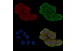 ABIN6263092 and ABIN6276728 staining Hela cells(30 min of UV treatment) by IF/ICC. (Monoamine Oxidase B anticorps  (Internal Region))
