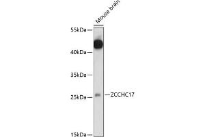 Western blot analysis of extracts of mouse brain, using ZCCHC17 antibody (ABIN7271546) at 1:1000 dilution. (ZCCHC17 anticorps  (AA 1-241))