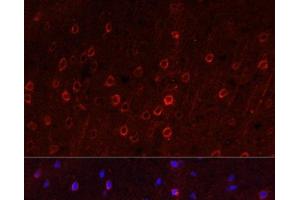 Immunofluorescence analysis of Rat brain using SLC1A1 Polyclonal Antibody at dilution of 1:100.