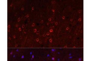 Immunofluorescence analysis of Rat brain using SLC1A1 Polyclonal Antibody at dilution of 1:100. (SLC1A1 anticorps)