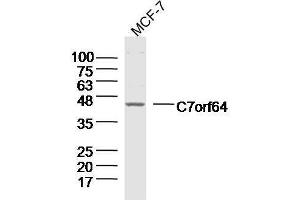 Lane 1: MCF-7 lysates probed with C7orf64 Polyclonal Antibody, Unconjugated  at 1:300 overnight at 4˚C. (C7orf64 anticorps  (AA 1-100))
