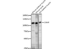 Western blot analysis of extracts of various cell lines, using COMP antibody (ABIN6127650, ABIN6138864, ABIN6138866 and ABIN6221502) at 1:1000 dilution. (COMP anticorps  (AA 20-160))