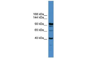 WB Suggested Anti-IFT88  Antibody Titration: 0. (IFT88 anticorps  (Middle Region))