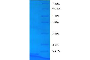 SDS-PAGE (SDS) image for ATP-Binding Cassette, Sub-Family B (MDR/TAP), Member 1B (ABCB1B) (AA 236-297), (partial) protein (His tag) (ABIN5712796)