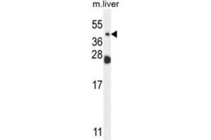 Western Blotting (WB) image for anti-Sialidase 4 (NEU4) antibody (ABIN2995626)