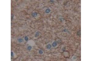 IHC-P analysis of Human Tissue, with DAB staining. (Metabotropic Glutamate Receptor 1 anticorps  (AA 165-592))