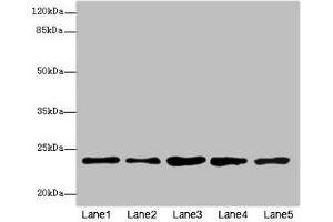 Western blot All lanes: RAB9A antibody at 7. (RAB9A anticorps  (AA 122-201))