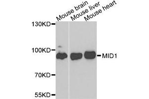 Western blot analysis of extracts of various cells, using MID1 antibody. (MID1 anticorps)