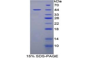 SDS-PAGE analysis of Rat MEC Protein. (Mucosae Associated Epithelia Chemokine Protéine)